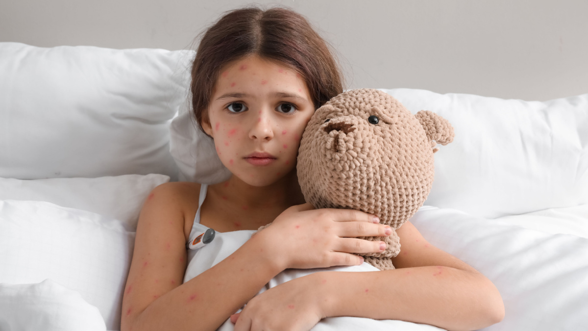 Little girl ill with chickenpox in bed.