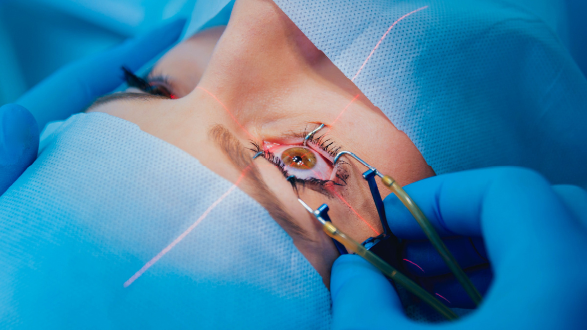 Laser vision correction. A patient and team of surgeons in the operating room during ophthalmic surgery. Eyelid speculum. Lasik treatment. Patient under sterile cover