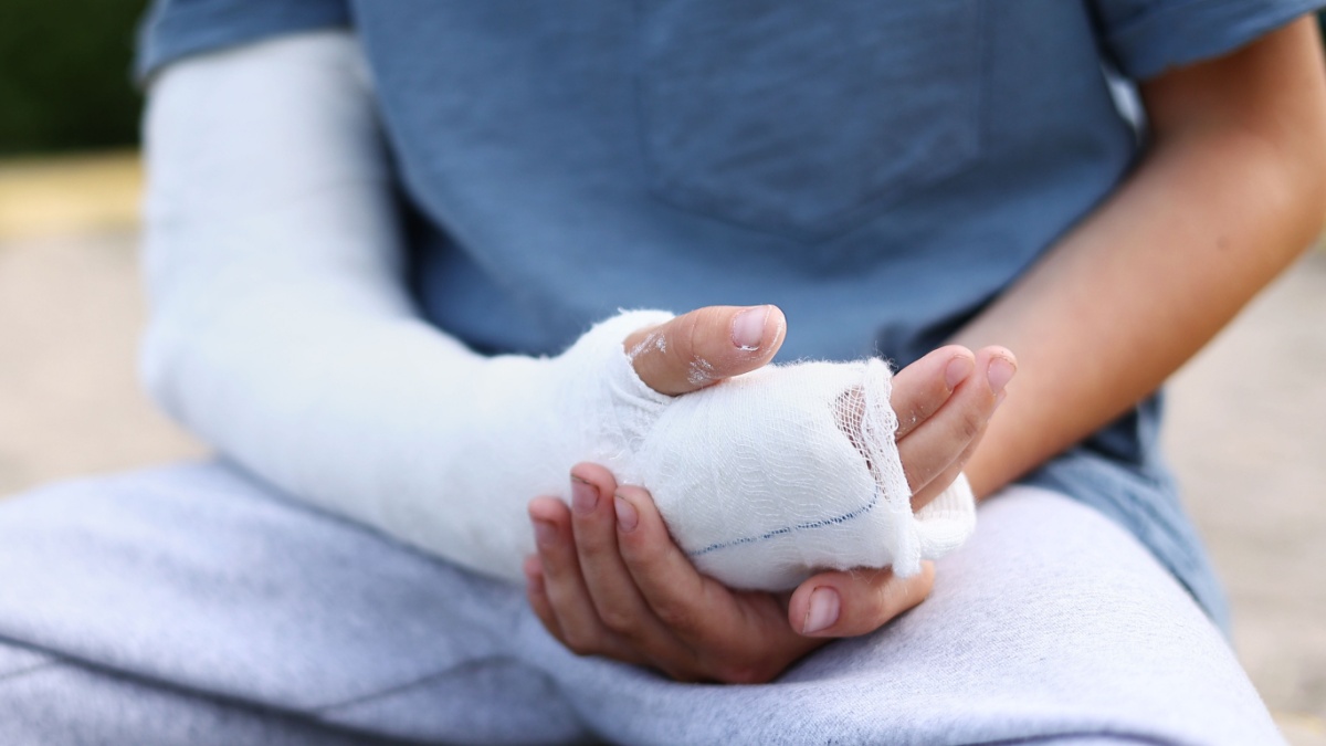 a child's arm is broken. little boy with a fractured limb outdoors. fracture injury in the summer holiday. kid is moving fingers in plaster cast on the arm